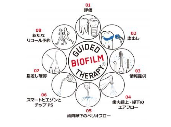 バイオフィルムの定期除去に関する画像