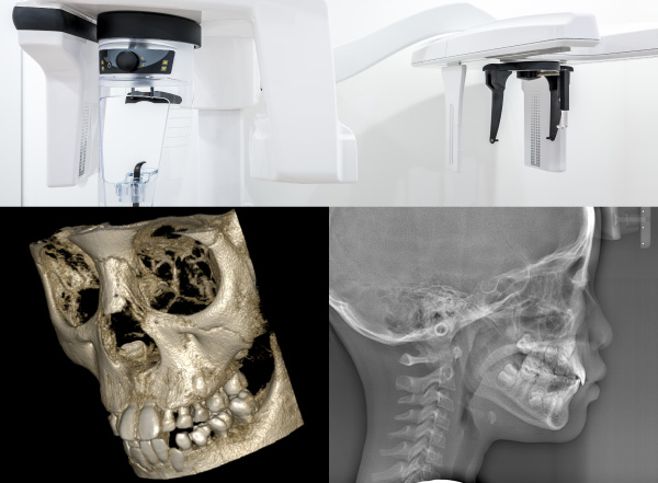 歯科用CT&セファロレントゲン