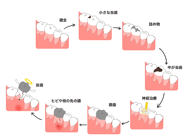 歯の一生について